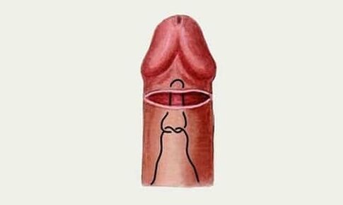 penis glans